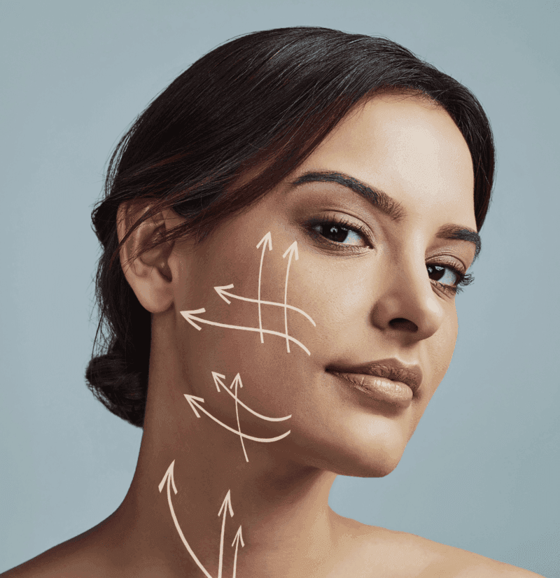 Neck Lift